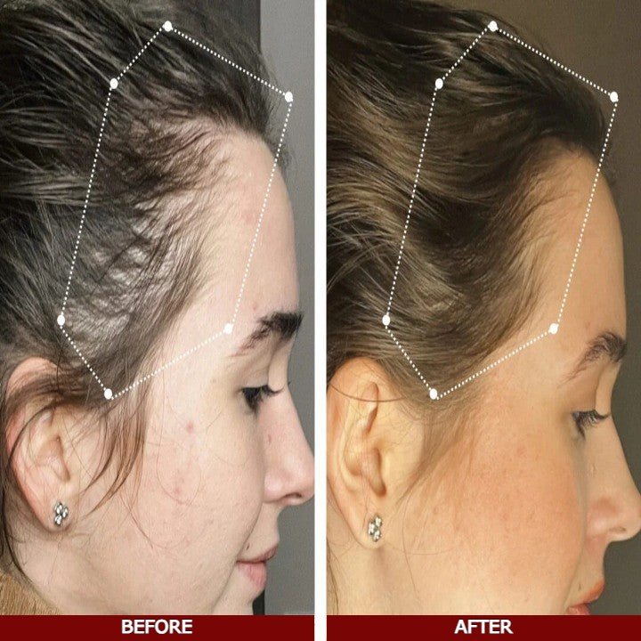 LOVILDS™ Advanced Hair Growth Serum