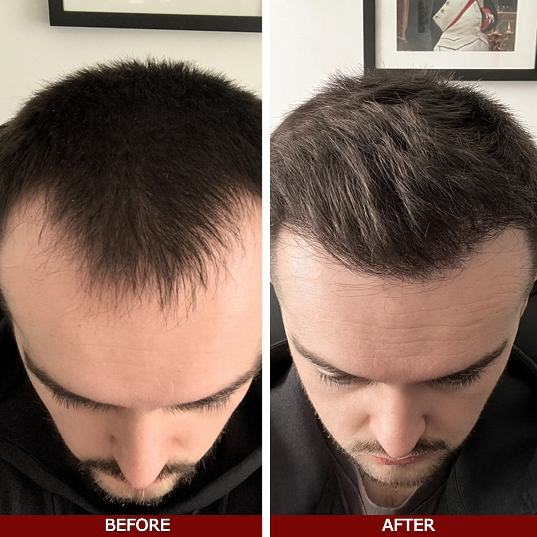 LOVILDS™ Advanced Hair Growth Serum